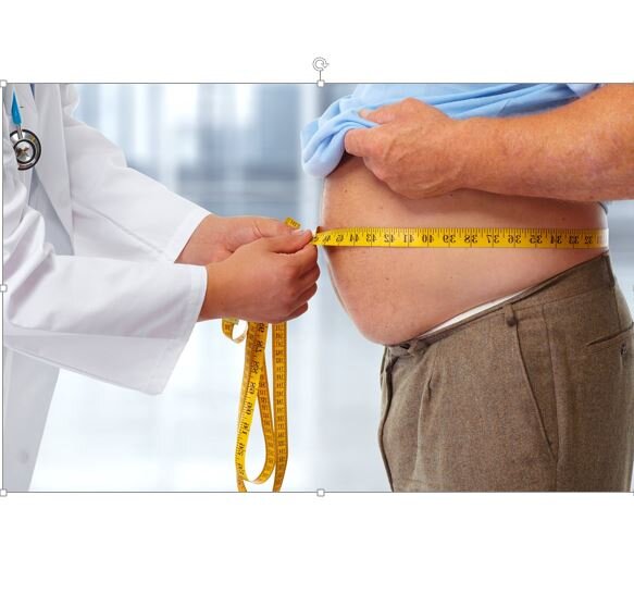 “Top Ten” – Reasons For Attributing Obesity To A Virus